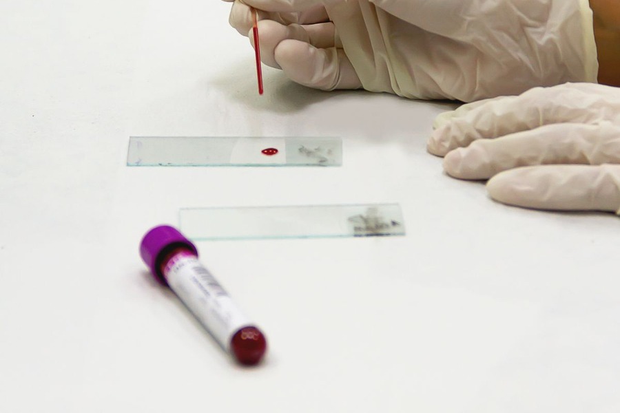 Technicien de laboratoire préparant un échantillon de sang