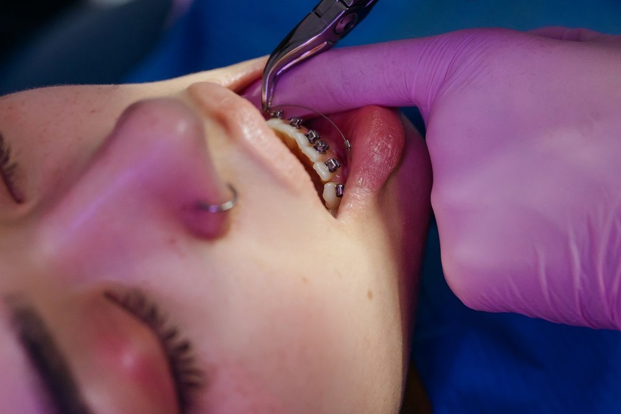 Gros plan sur un dentiste examinant les dents d'un patient